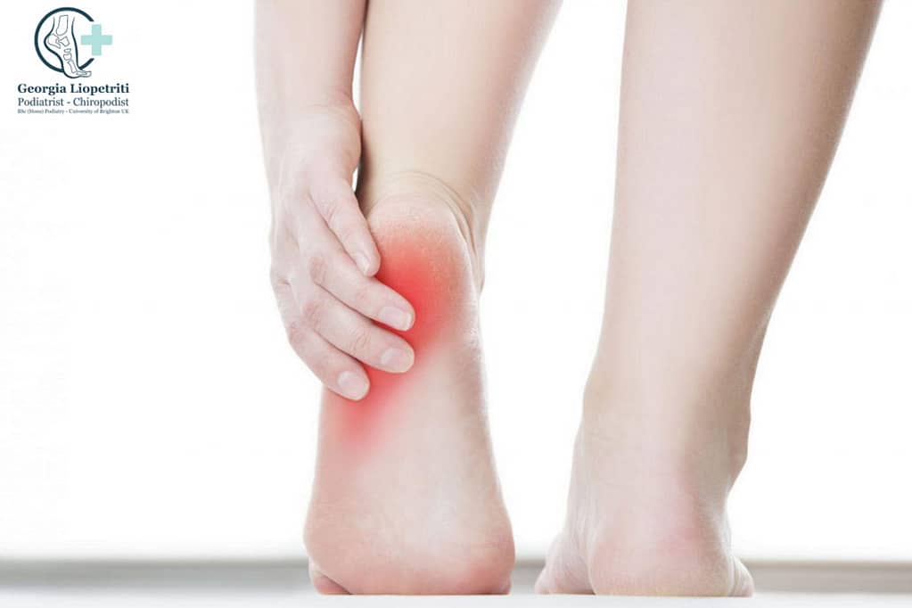 Paphos Podiatrist Heel Pain