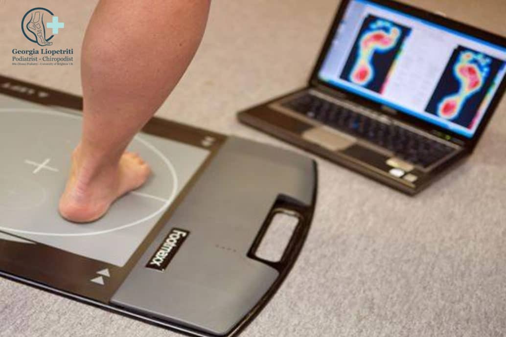 Paphos Podiatrist Gait analysis and Orthotics Paphos Podiatrist Gait analysis and Orthotics