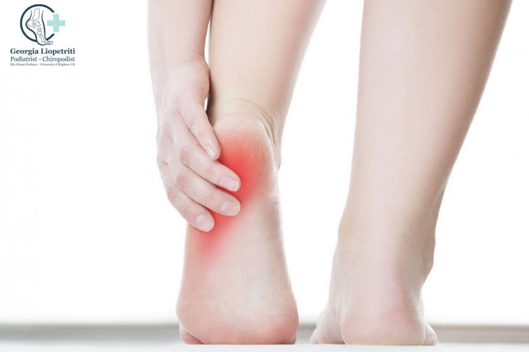 Paphos Podiatrist Heel Pain