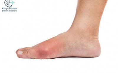 Gout